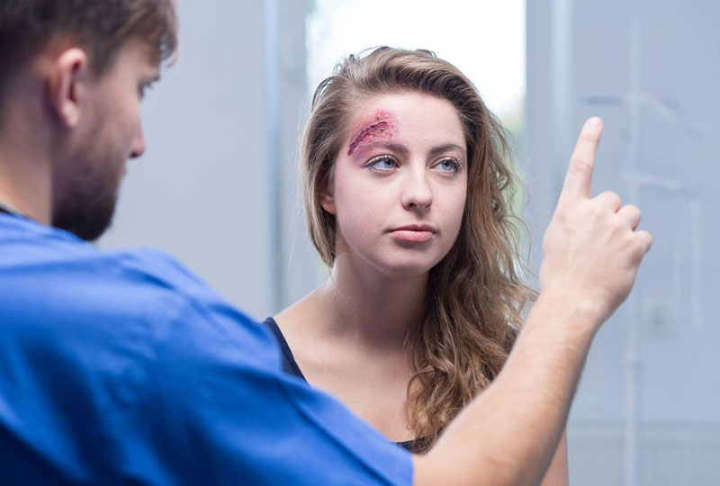 What to Do if You’ve Suffered a Brain Injury Injured Women