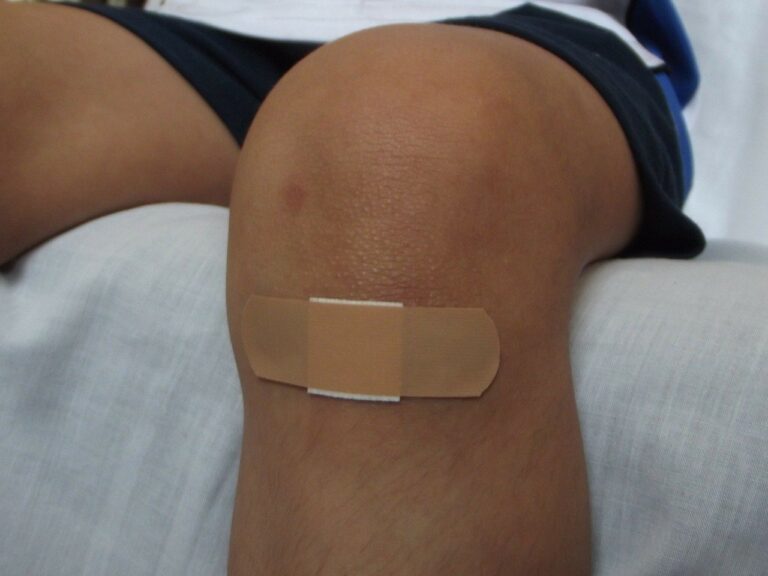 Injured knee of a boy in Ontario, Canada